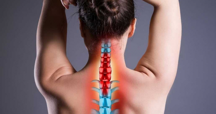 Boyun-Fıtığı-Fizik-Tedavi